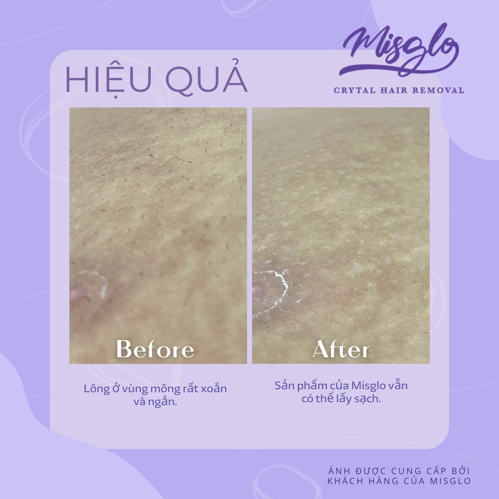 US-UK  Đá tẩy lông không đau Nano-Crystalline Misglo cao cấp Full Box