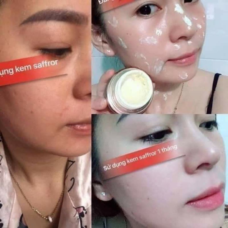 KEM NÁM SAFFRON 20gr MẪU MỚI NHẤT