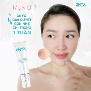 Xả kho nghỉ tết kem dưỡng dành cho da mụn onyx