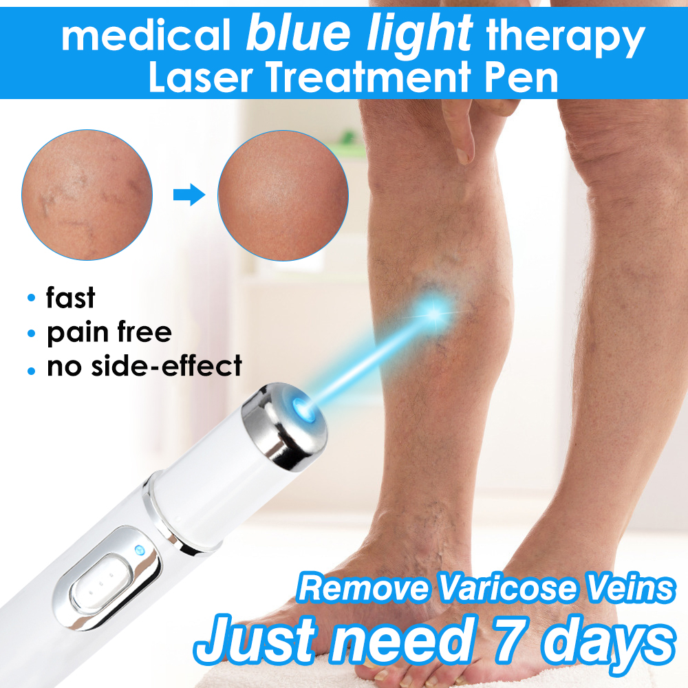 [Hàng mới về] Bút laser ánh sáng xanh giúp giảm mụn xóa mờ nếp nhăn Kd-7910