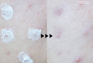 Kem trị mụn sưng đỏ Ciracle Red spot cream