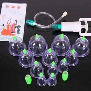 Bộ giác hơi ko dùng lửa