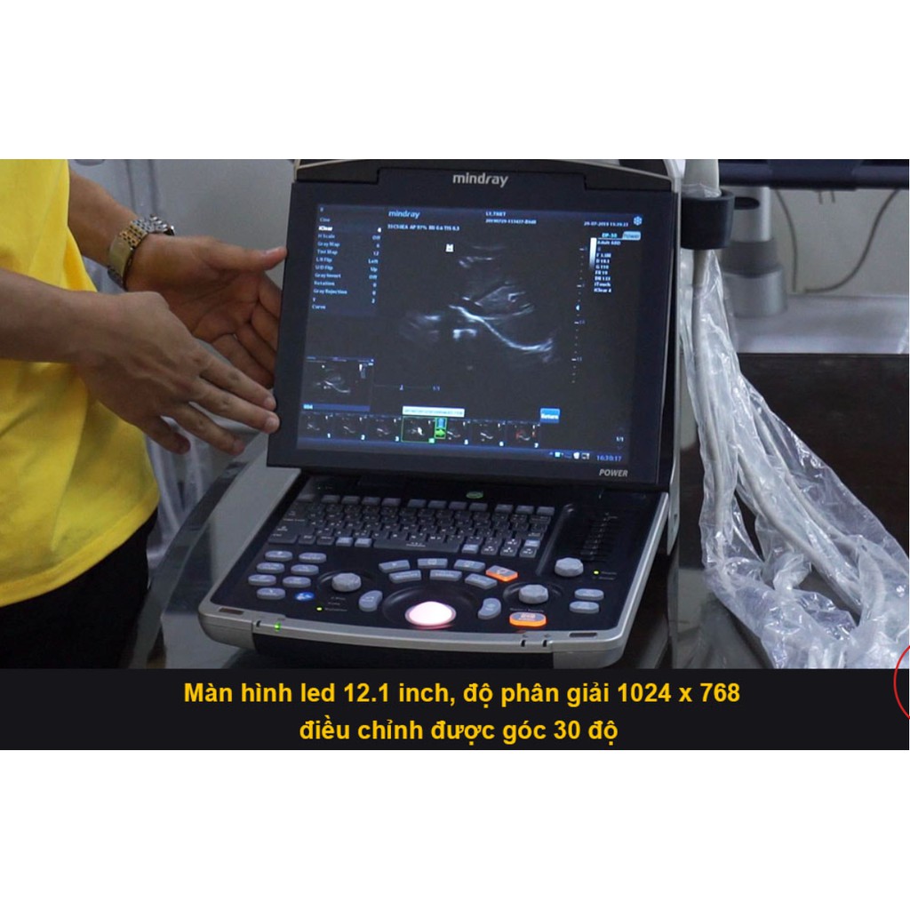 MÁY SIÊU ÂM XÁCH TAY MINDRAY DP 30 BẢO HÀNH CHÍNH HÃNG 12 THÁNG