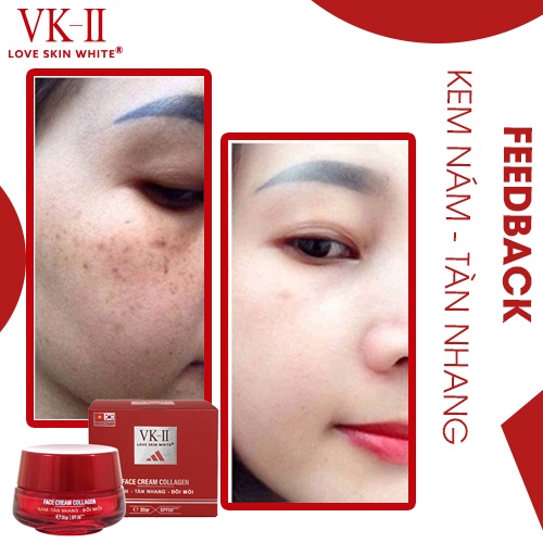 Kem dưỡng da mờ nám, tàn nhang, đồi mồi VK II Love Skin White Face Cream Collagen 35g
