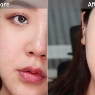Bộ phấn nước OHUI Ultimate Cover Cushion