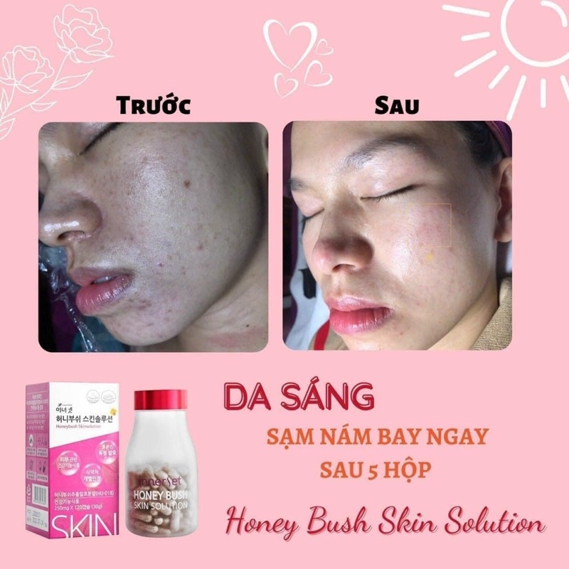 Viên uống chống nắng Honeybush Skin Solution