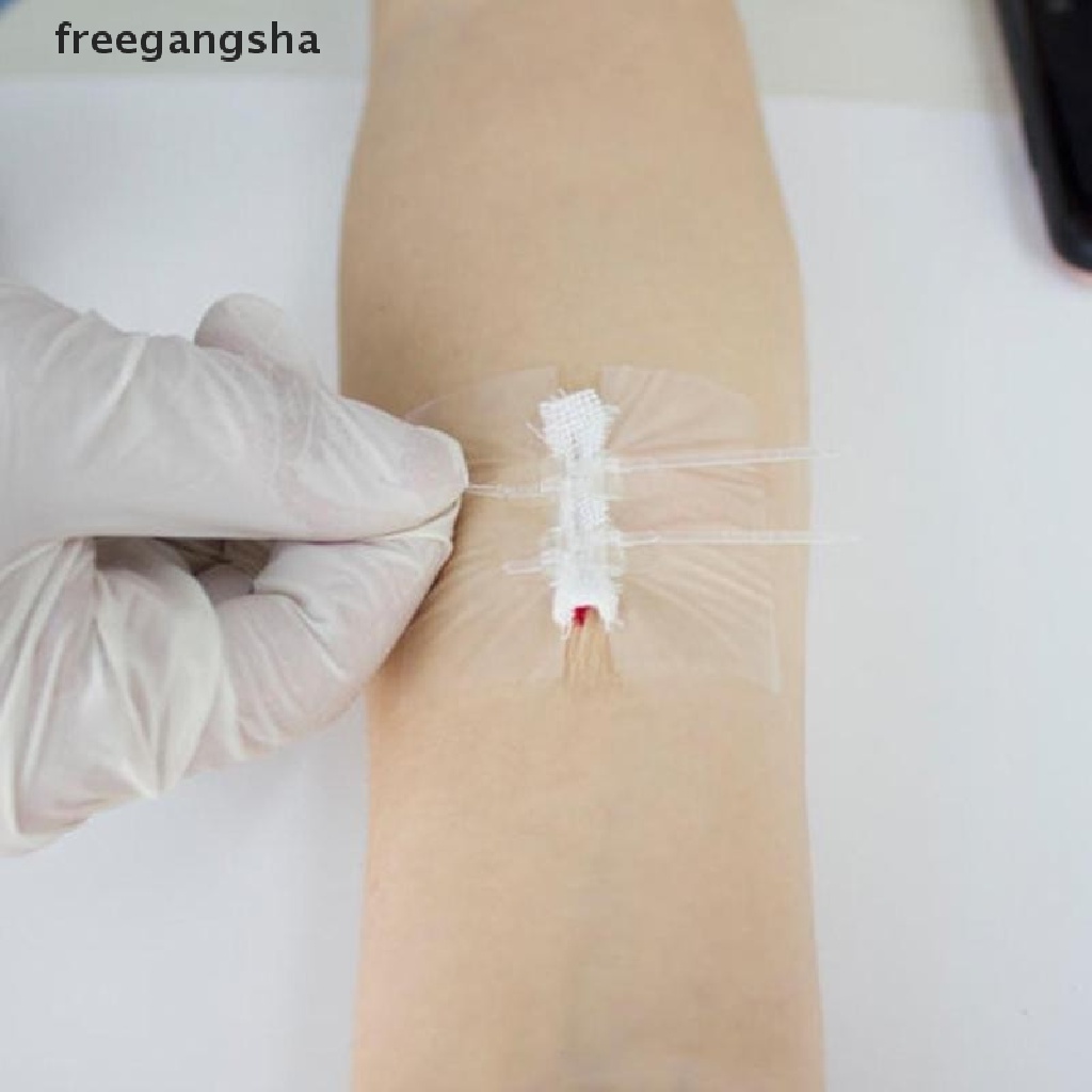 [FREG] Zipper Band-aid Painless Wound Closure Device Suture-free Wound Dressing Patches FDH