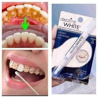 Trắng răng T WHITE