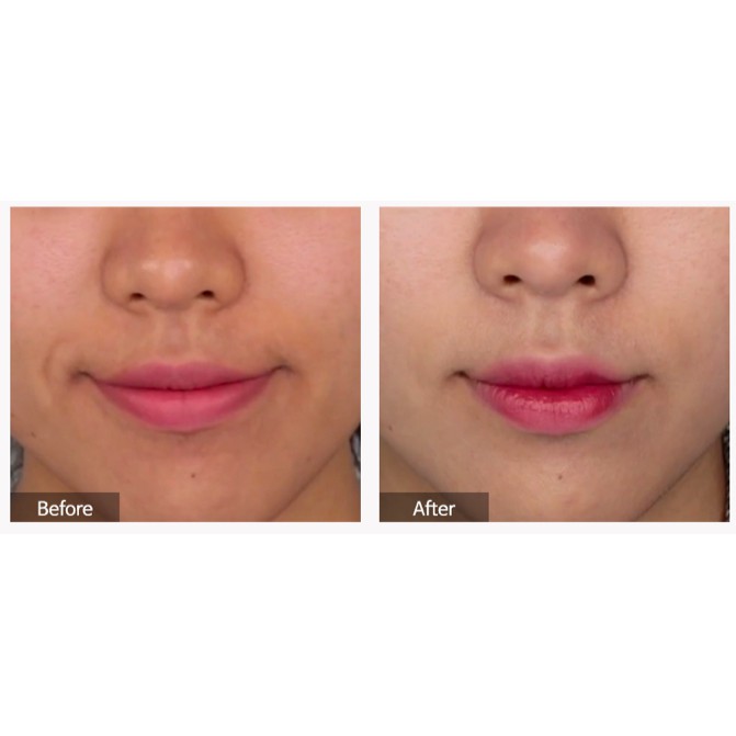 [Mã COS1904 giảm 8% đơn 300K] Kem Dưỡng Vitamin C Mờ Thâm, Nám, Dưỡng Trắng Da Tiam Red C Cream 50ml | BigBuy360 - bigbuy360.vn