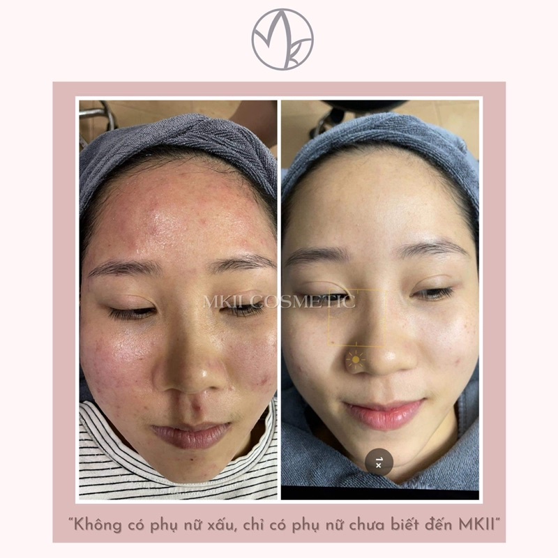 Serum Soothing phục hồi MKII COSMETICS