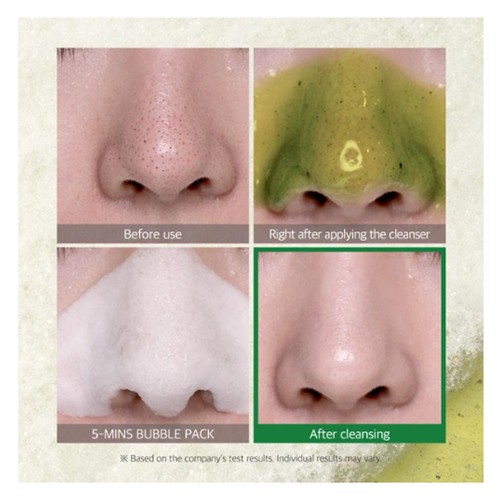 Rửa mặt tạo bọt trà xanh SOME BY MI BYE BYE BLACKHEAD 30 DAYS MIRACLE GREEN TEA TOX 120g