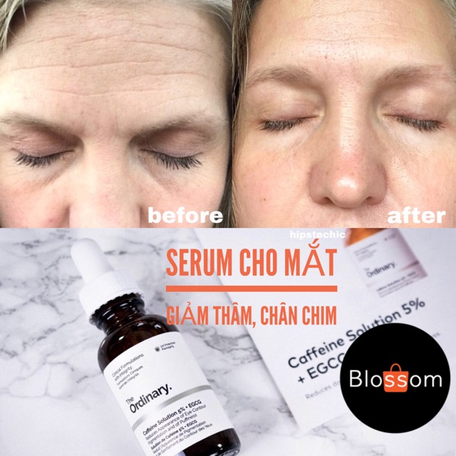 Tinh chất serum cho mắt The Ordinary giảm thâm, chân chim, lão hoá vùng mắt từ Caffeine EGCG | BigBuy360 - bigbuy360.vn