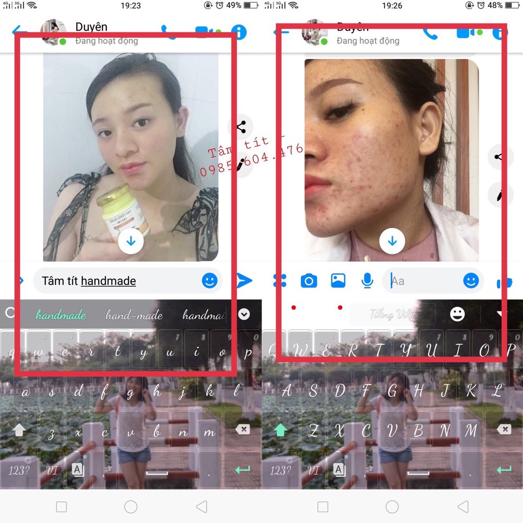 CAO NGHỆ MẶT TRẮNG DA | BigBuy360 - bigbuy360.vn