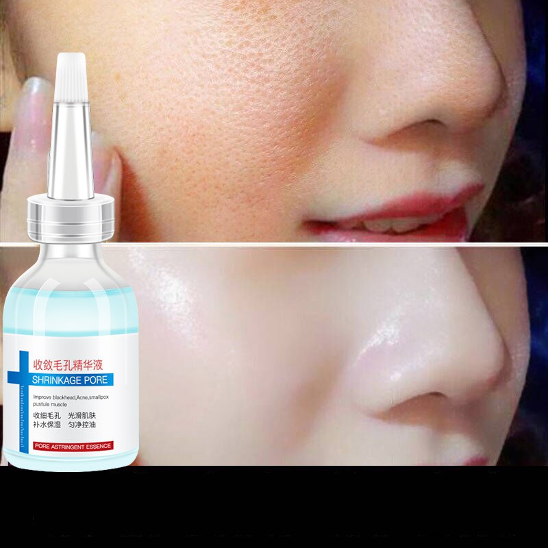 Serum dưỡng da se khít lỗ chân lông giảm mụn đầu đen Shrinkage Pore Qianzi Sena Beauty | BigBuy360 - bigbuy360.vn