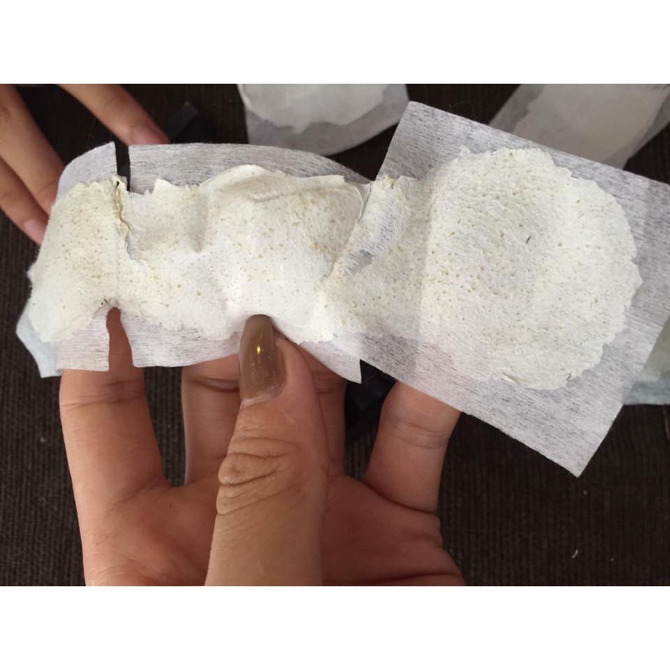 Lột mụn đầu đen