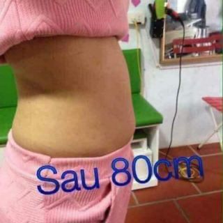 KEM TAN MỠ 3D
