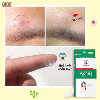 Miếng dán mụn Acnes 24 miếng