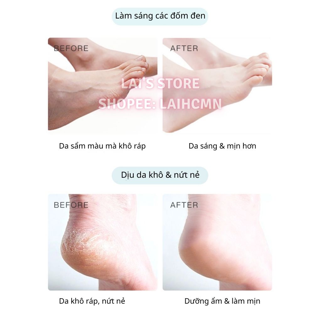 Mặt Nạ Tay Chân Mèo Chongzi Ủ Tay Dưỡng Ẩm, Cải Thiện Nứt Tay Chân, Làm Mềm Mịn, Trắng Da, Mờ Vết Thâm - LAI'S STORE
