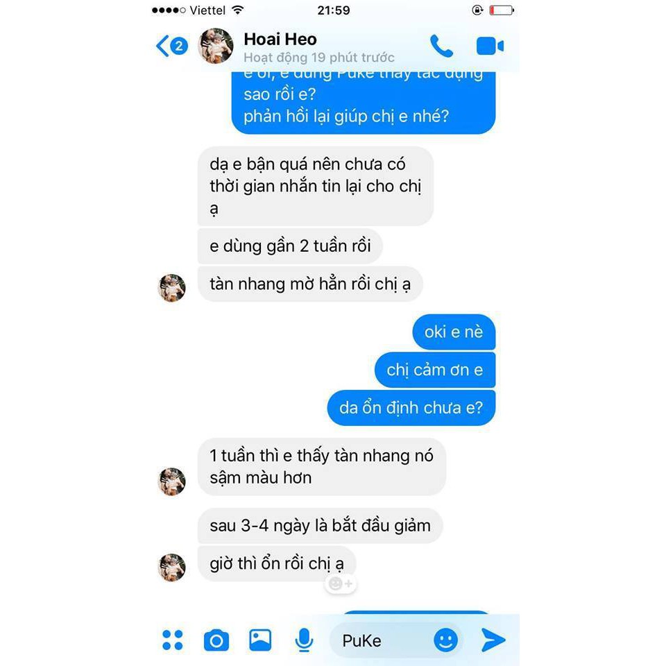 💗 MỚI 💗 Hết Nám Tàn Nhang Lâu Năm Nhờ Serum Pukel Plus