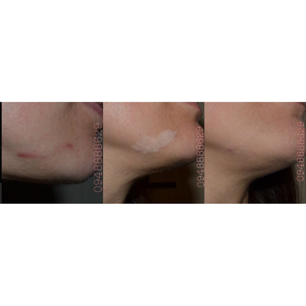 Bút Che Khuyết Điểm Eveline Mẫu Mới Nhất | BigBuy360 - bigbuy360.vn