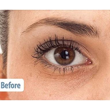 Kem Dưỡng Mắt Ngừa Lão Hóa Chiết Xuất Nọc Rắn Balance Active Formula Snake Venom Eye Cream 15ml | BigBuy360 - bigbuy360.vn