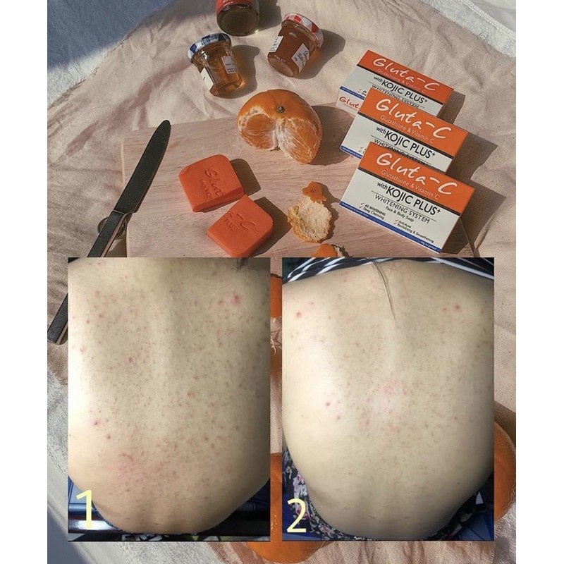 Xà phòng Gluta-C giảm mụn, mờ thâm sau mụn, hàng có sẵn giao ngay