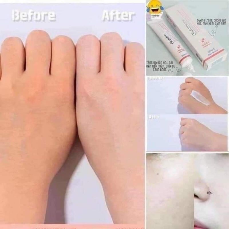 KEM DƯỠNG TRẮNG DA MELASMA GLUTATHION Brightening Tone-up cream