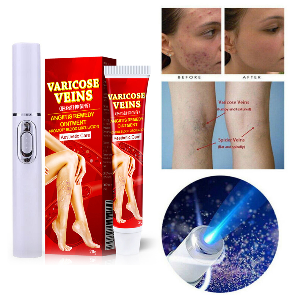 COD Varicose Veins Cream and Blue Light Therapy Pen Varicose Vein Ointment Set