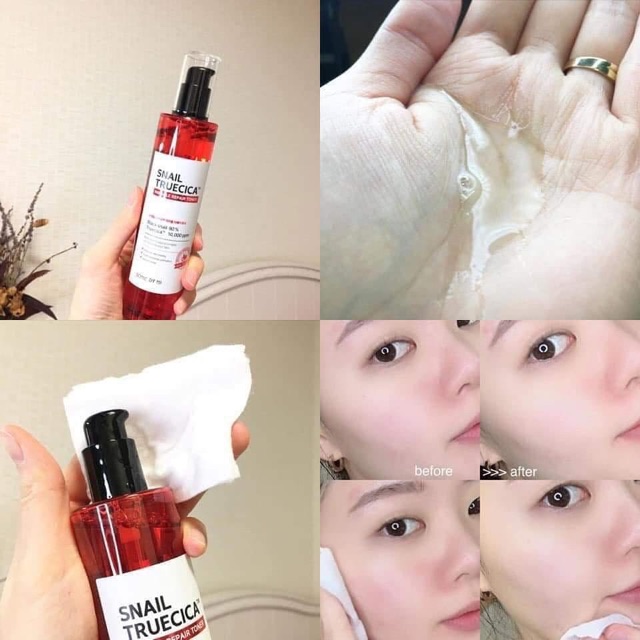 Set dưỡng da ốc sên Some By mi Snail Truecica Miracle Repair Starter Kit