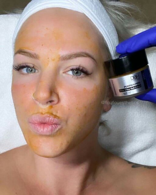 DBH peel bí đỏ 30ml