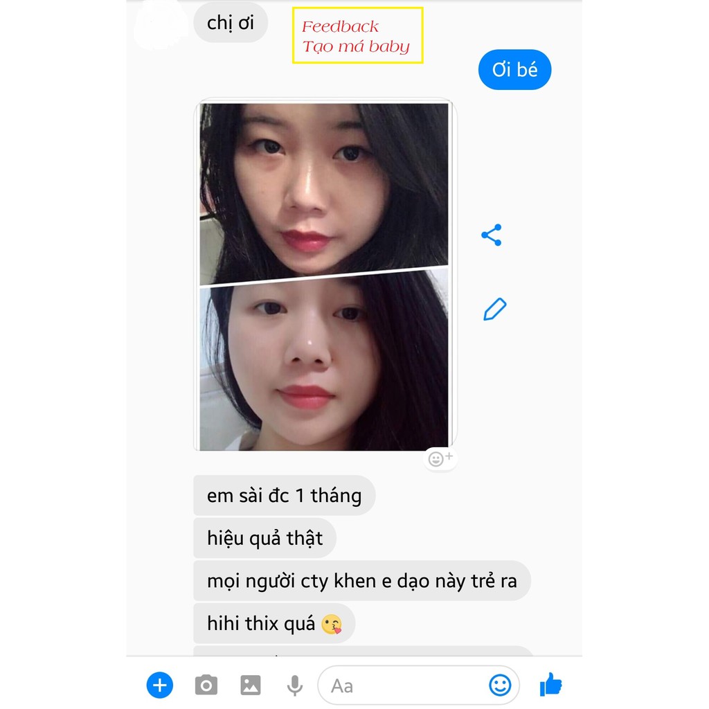 Ampoule Làm Đầy má, Thái dương