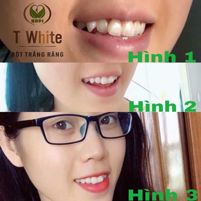 Bột Trắng Răng T_White