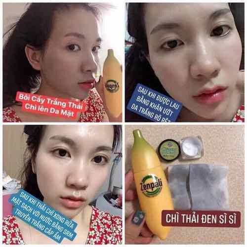 Chuối Cấy Trắng Zenpali, Chuối Giảm Thâm, Chuối Thải Chì Zenbali Whitening Detox Cream 30gr | BigBuy360 - bigbuy360.vn