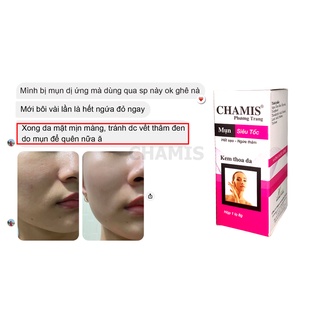 Kem giảm mụn siêu tốc, mờ thâm sẹo CHAMIS