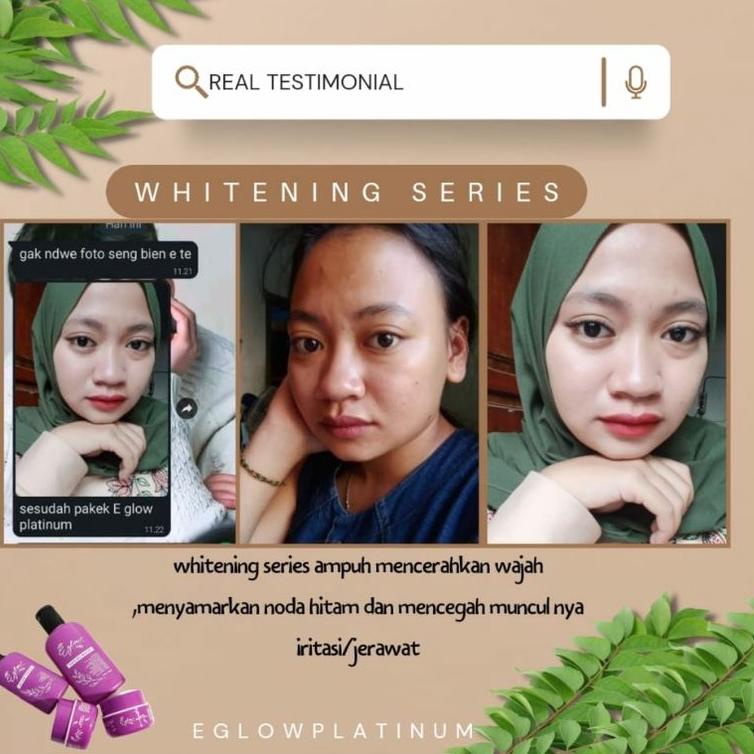 Pkd-557|⭐ Đai Nịt Bụng Và busui Bạch Kim An Toàn Cho Mẹ Bầu⭐Xe tăng | BigBuy360 - bigbuy360.vn