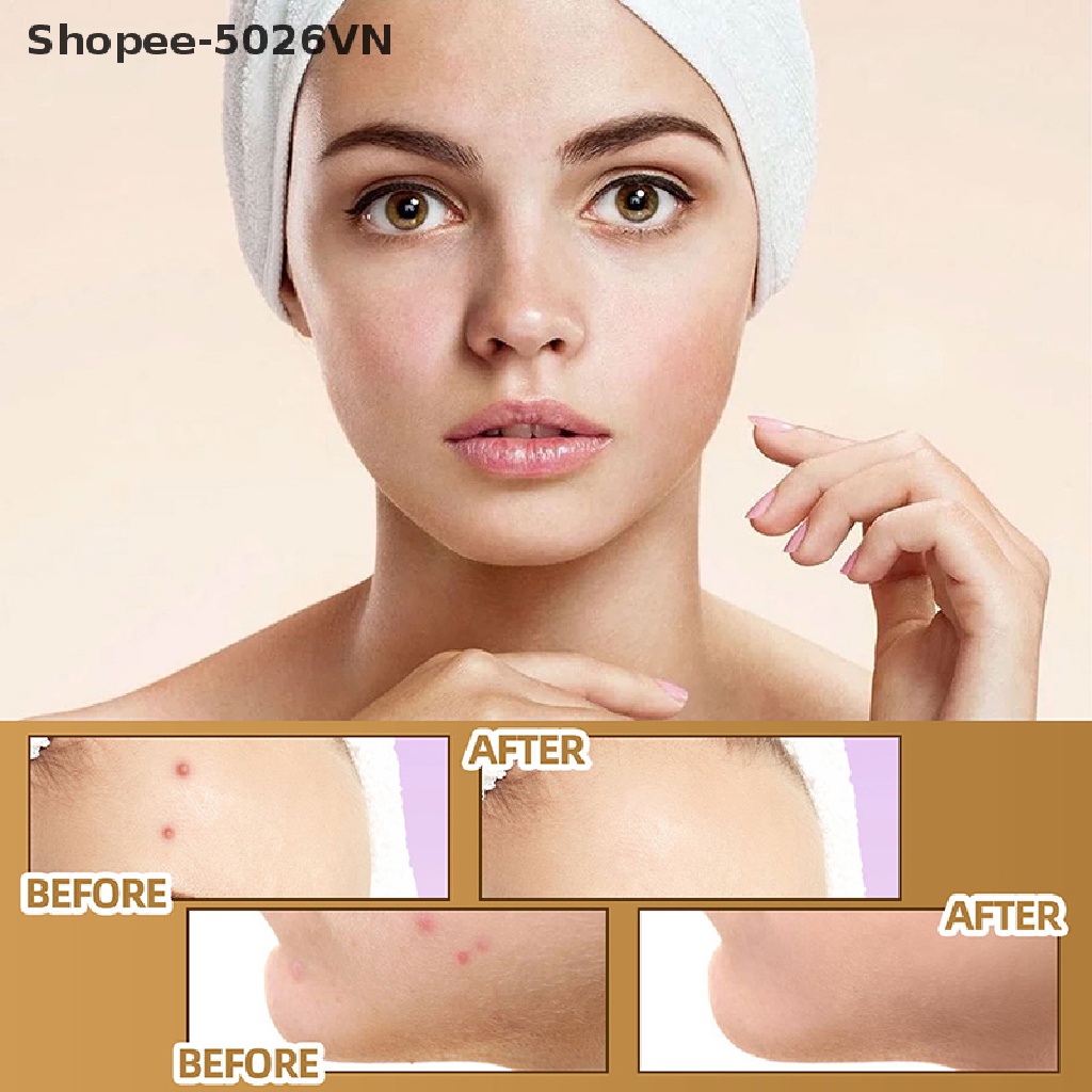 Bộ 60 Miếng Dán Che Khuyết Điểm Hình Xăm Chống Nước Che Phủ Mỏng