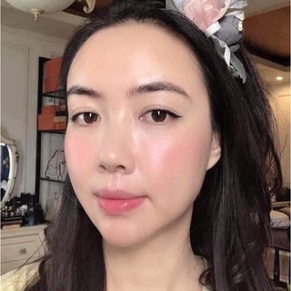 (Mã NSF020280 giảm 80K) Serum AHC Sale Cực Khủng