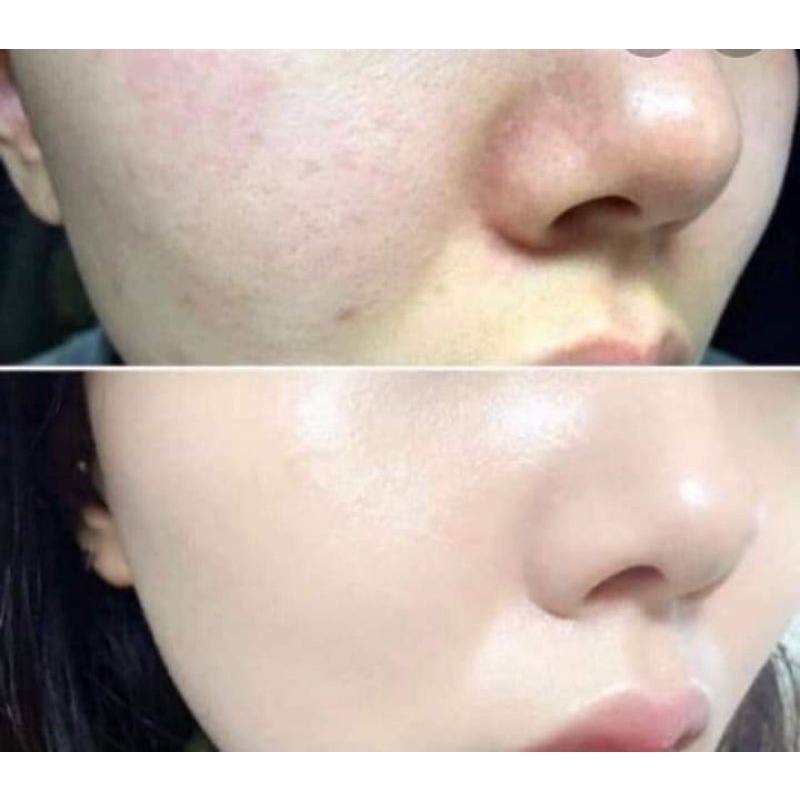 Oridinary niacinamide | BigBuy360 - bigbuy360.vn