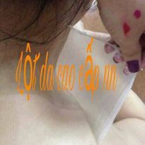 Lột trắng toàn thân NN ra mảng to