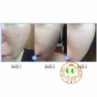 Bột đậu đỏ 100g ĐẮP MẶT TẮM TRẮNG SIÊU MỊN