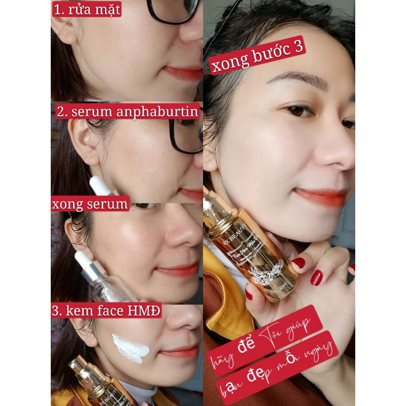 Kem face hoa mẫu đơn 8xbeauty(serum và mặt nạ)