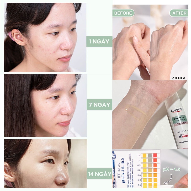 Tinh Chất Giảm Thâm, Dưỡng Sáng Cho Da Mụn Eucerin Acne-Oil Control Pro Acne Triple Effect Serum 40ml