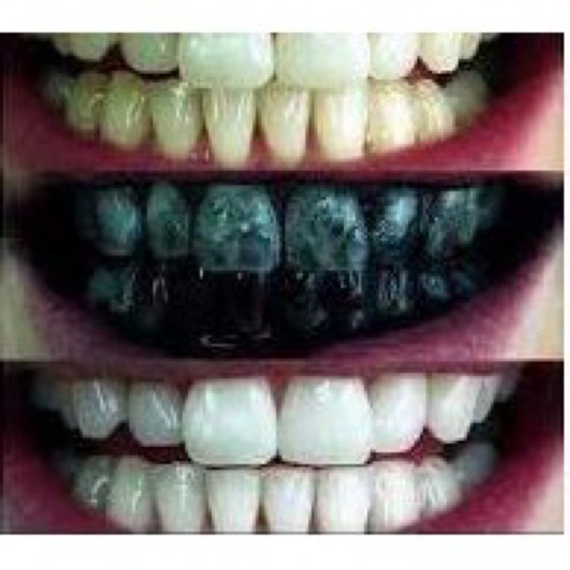 Bột than hoạt tính trắng răng GLORY SMILE chất lượng cao made in USA