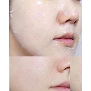 Mặt Nạ Banobagi Stem Cell Vitamin Mask (Mẫu mới - hộp 10 miếng)