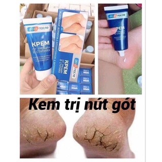 Kem nứt gót chân nga kpem 50ml