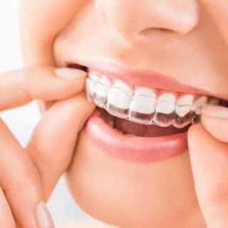 Miếng dán làm trắng răng Prokudent