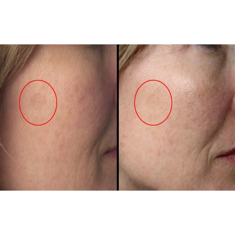 [ CTy ] Tinh chất Timeless Vitamin B5 + Hyaluronic Acid ( 30mL ) | BigBuy360 - bigbuy360.vn