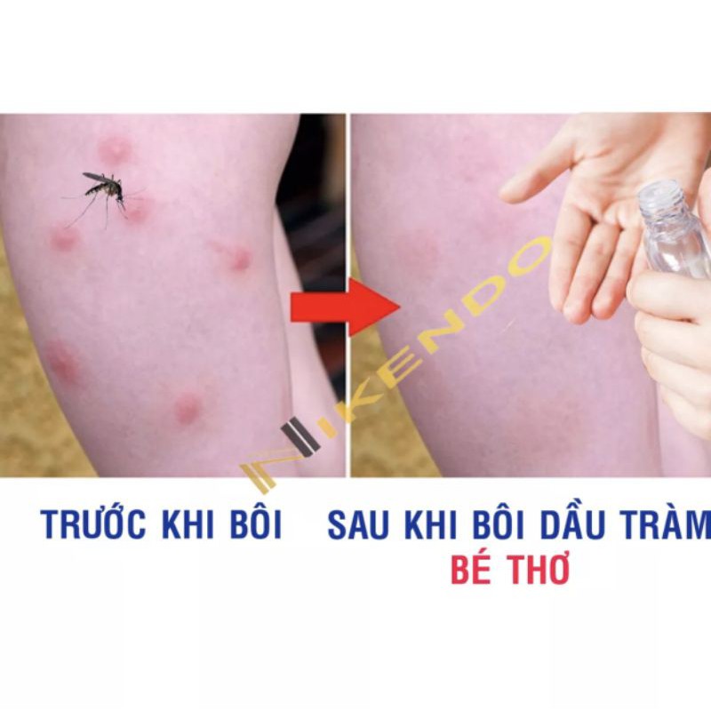 Tinh dầu tràm Bé Thơ 50ml cho mẹ và bé