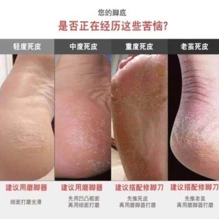 Thanh đá chà gót chân tẩy tế bào chết hai mặt tiện dụng