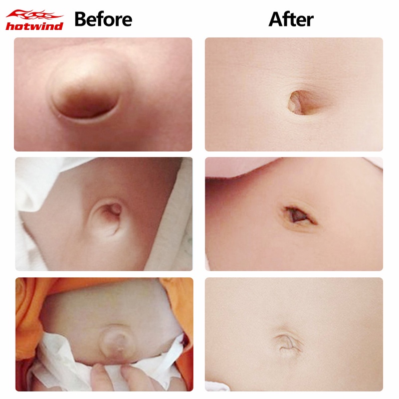 Hw (Hàng Mới Về) Set 2 Đai Quấn Bụng Thoáng Khí Bảo Vệ Rốn Cho Bé Sơ Sinh